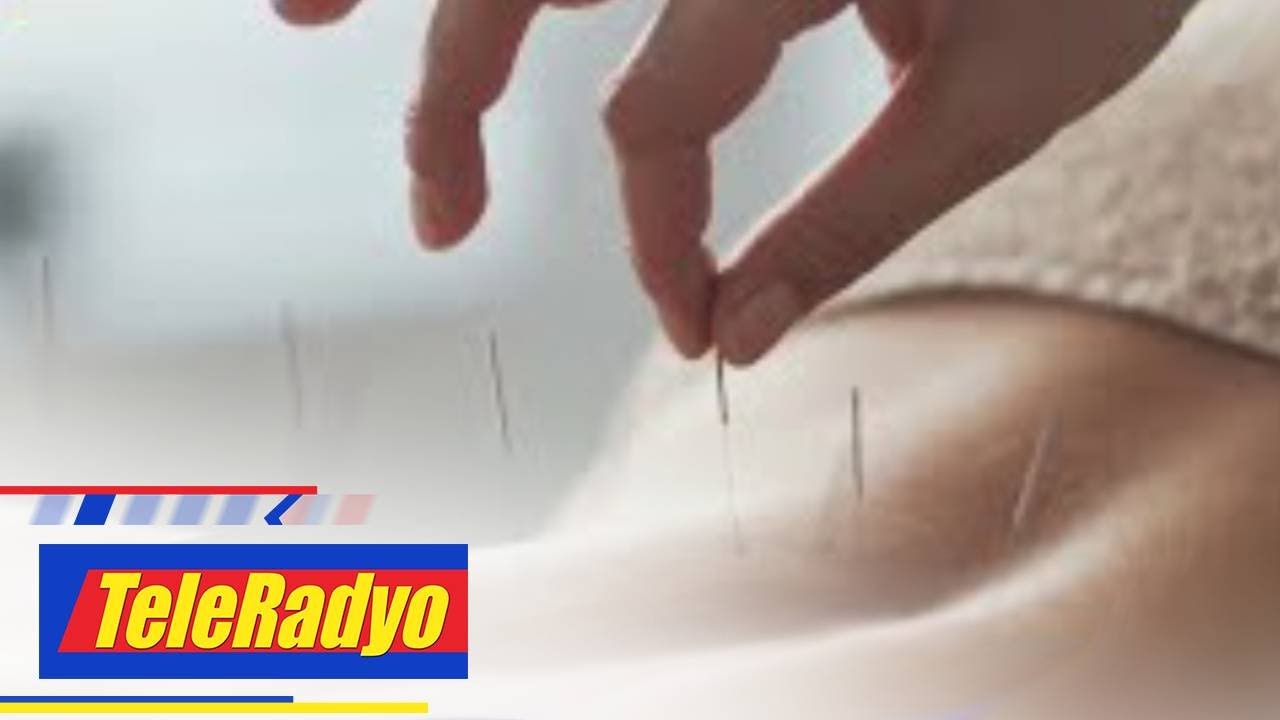 ALAMIN: Paano gumagana ang acupuncture sa katawan | TeleRadyo
