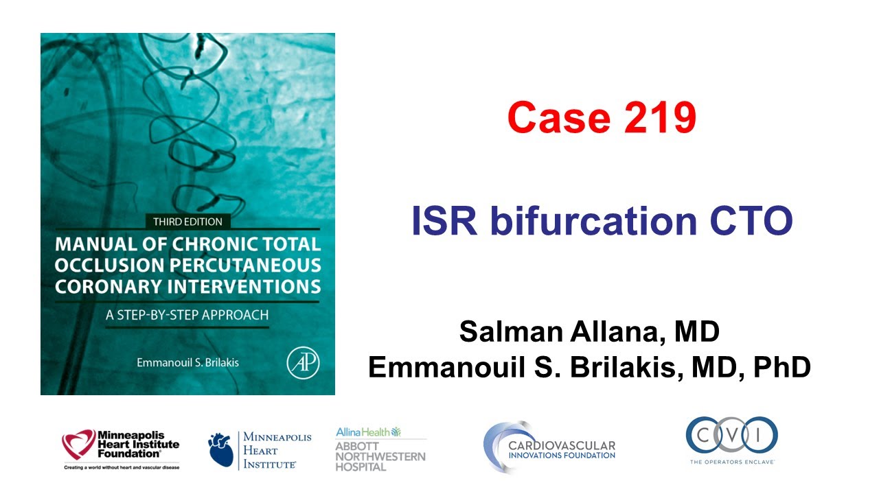 Case 219: Manual of CTO PCI - ISR CTO with bifurcation
