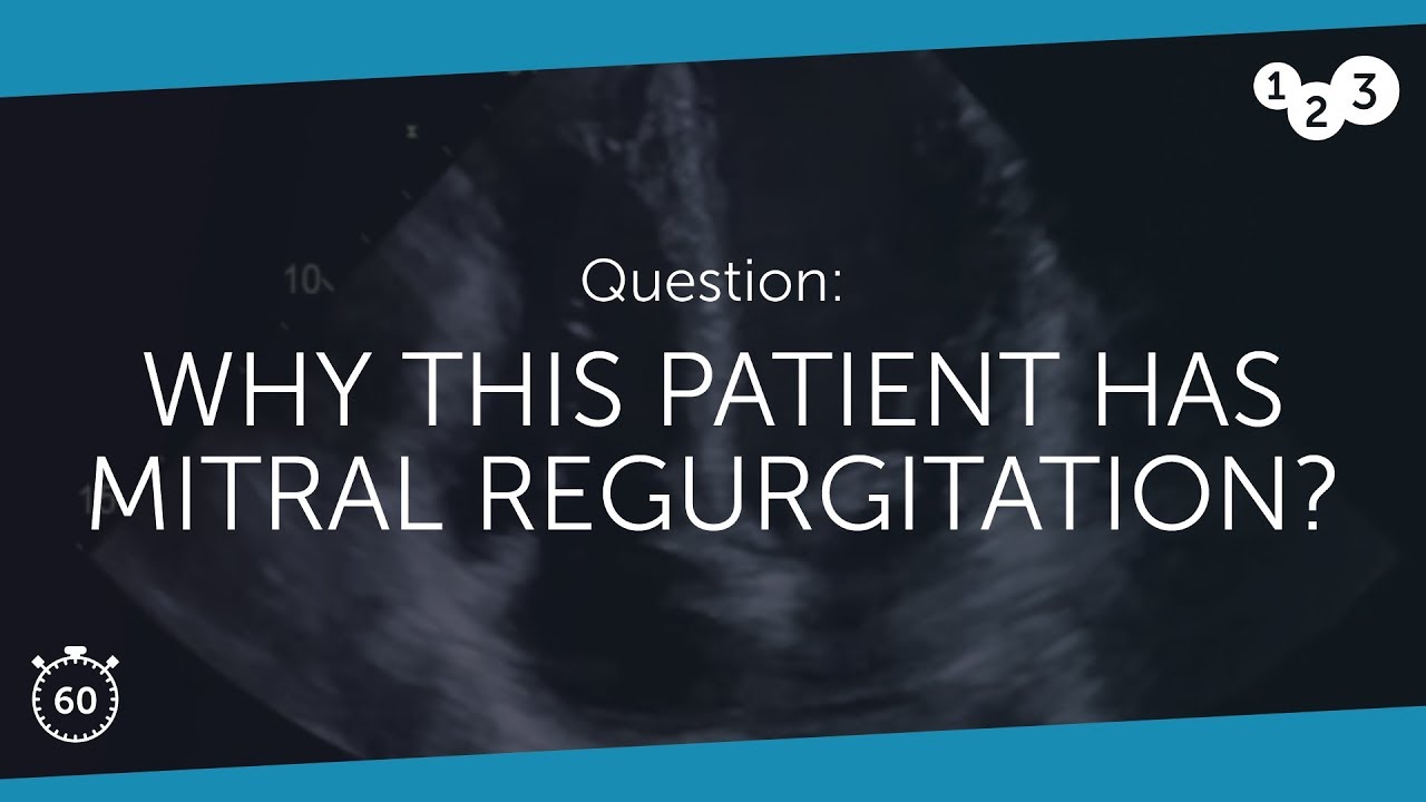 60 Seconds of Echo Teaching Question: Why this patient has MR?