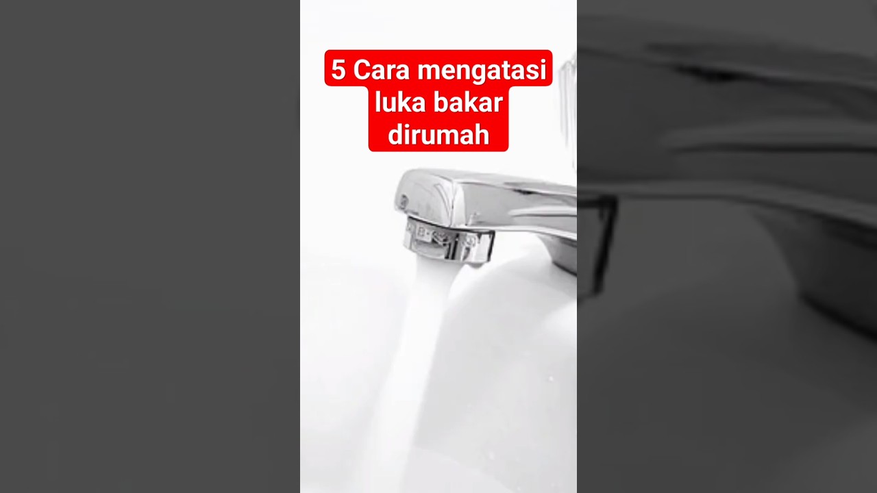 5 Cara mengatasi luka bakar dirumah 