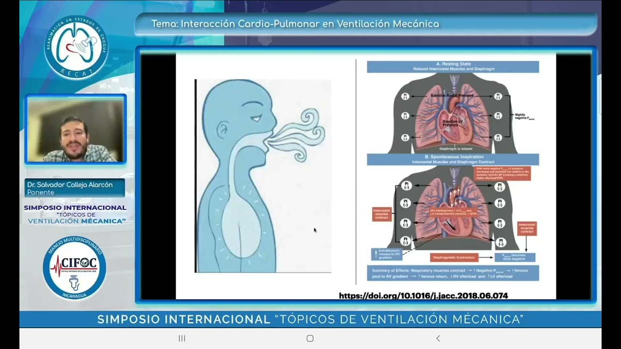 interacción cardio pulmonar en VM