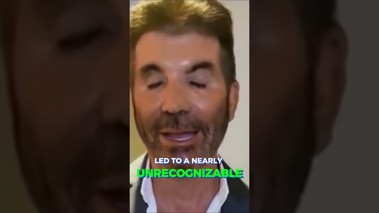 Трагическая пластическая операция Саймона Коуэлла