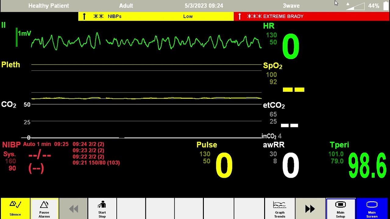 Anesthesia Scenario