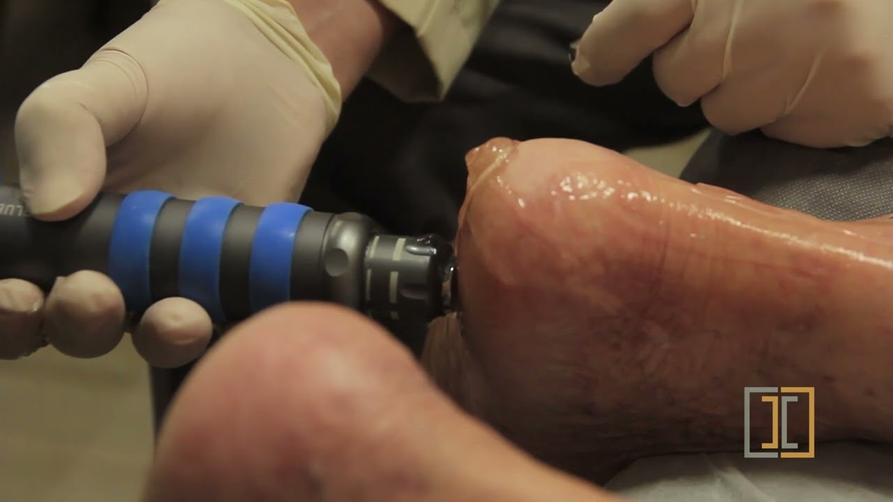 Terapia de Choque