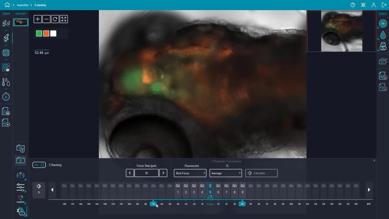 How to perform a z-stack image acquisition using CellReporterXpress