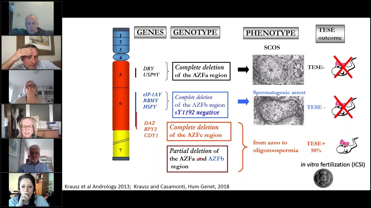 Genetic diagnosis of azoospermia from chromosomes to whole exome analysis