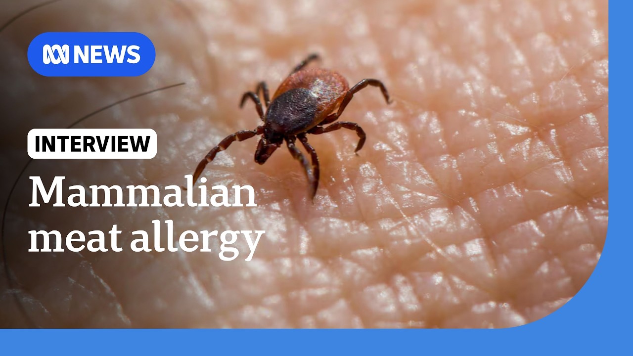 What is mammalian meat allergy and what role do ticks play? | ABC NEWS