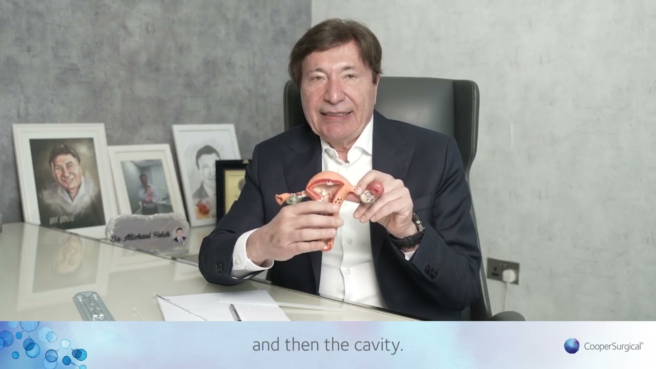 Dr. Michael Fakih reveals why he recommends Wallace­®­ Sure-Pro™ for embryo transfer (ET).