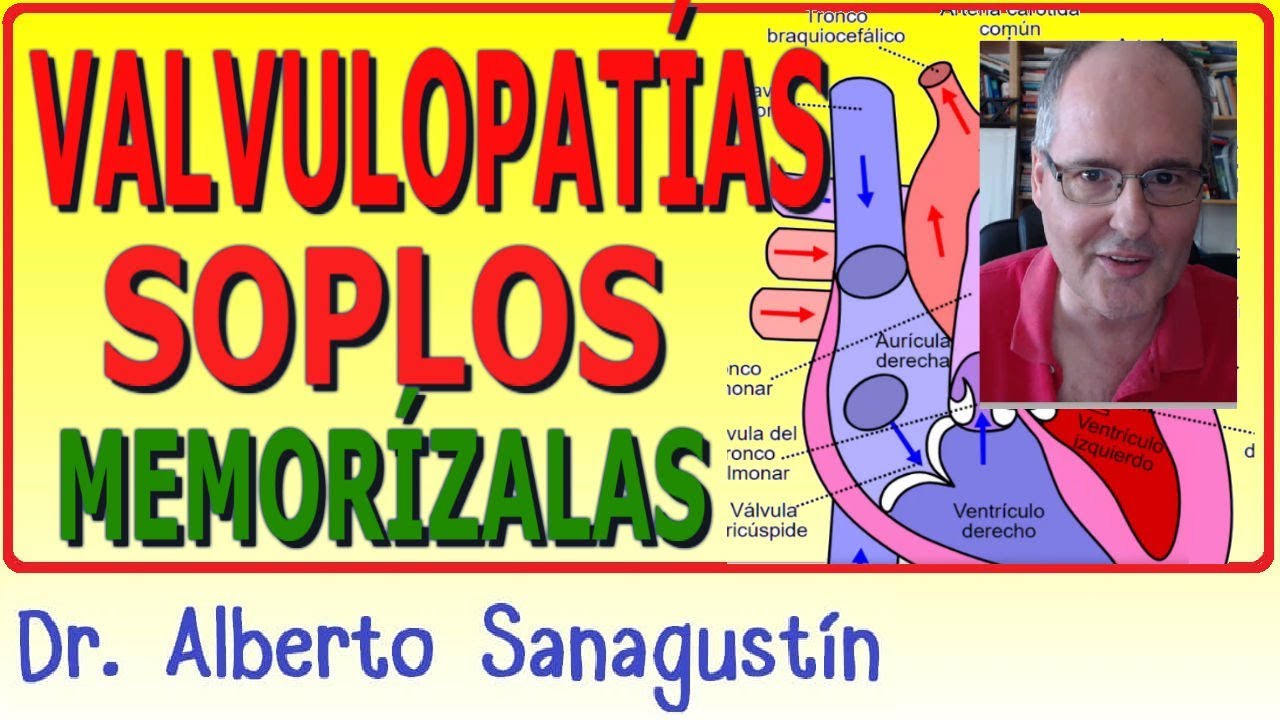 Memoriza las VALVULOPATÍAS y SOPLOS ✅ rápido y fácil