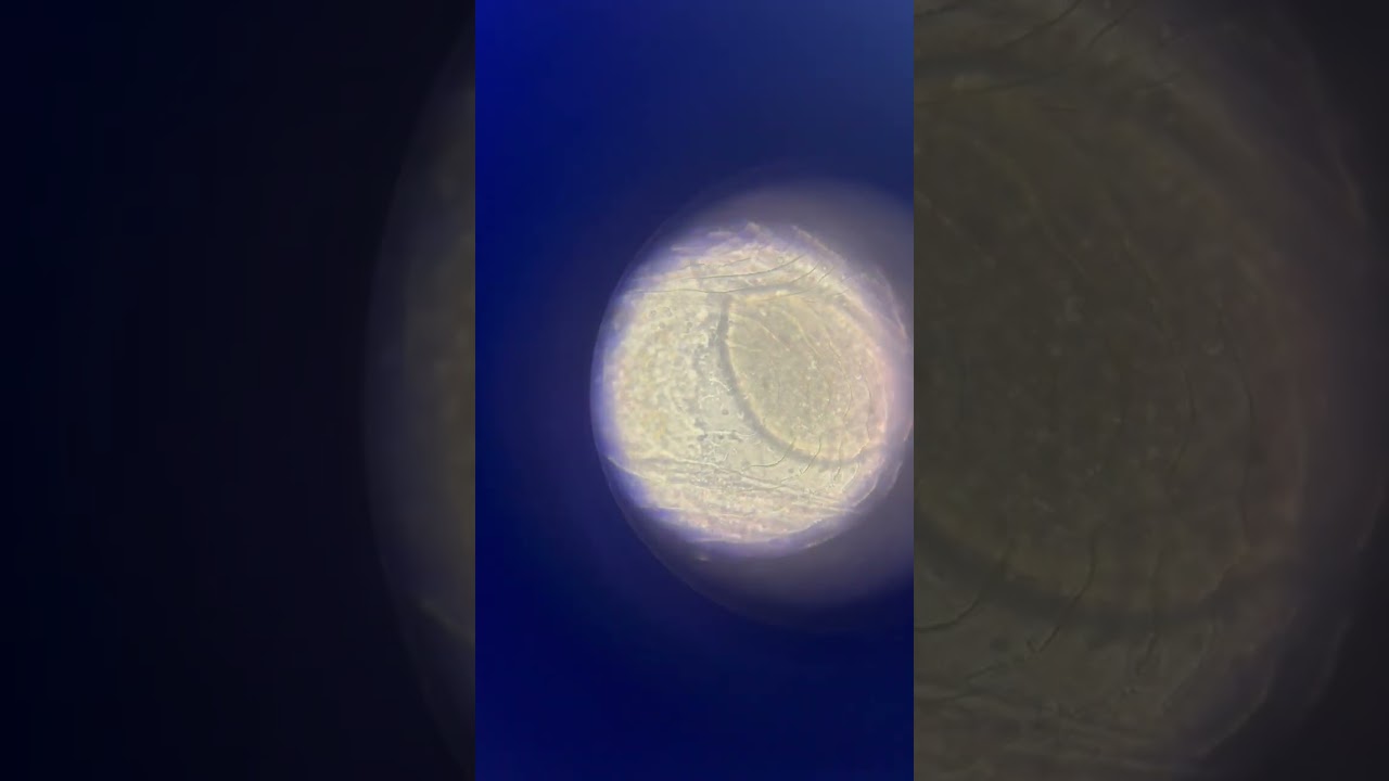 Marine Ich under the Scope