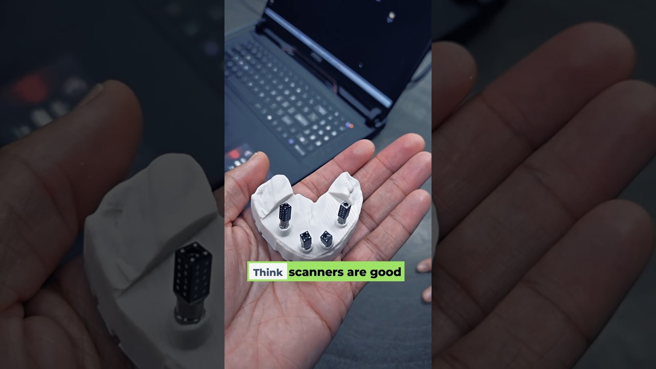 ICAM4D: Full-Arch Implant Scans in 60 Seconds? | Digital Dentistry Breakthrough #prosthodontics