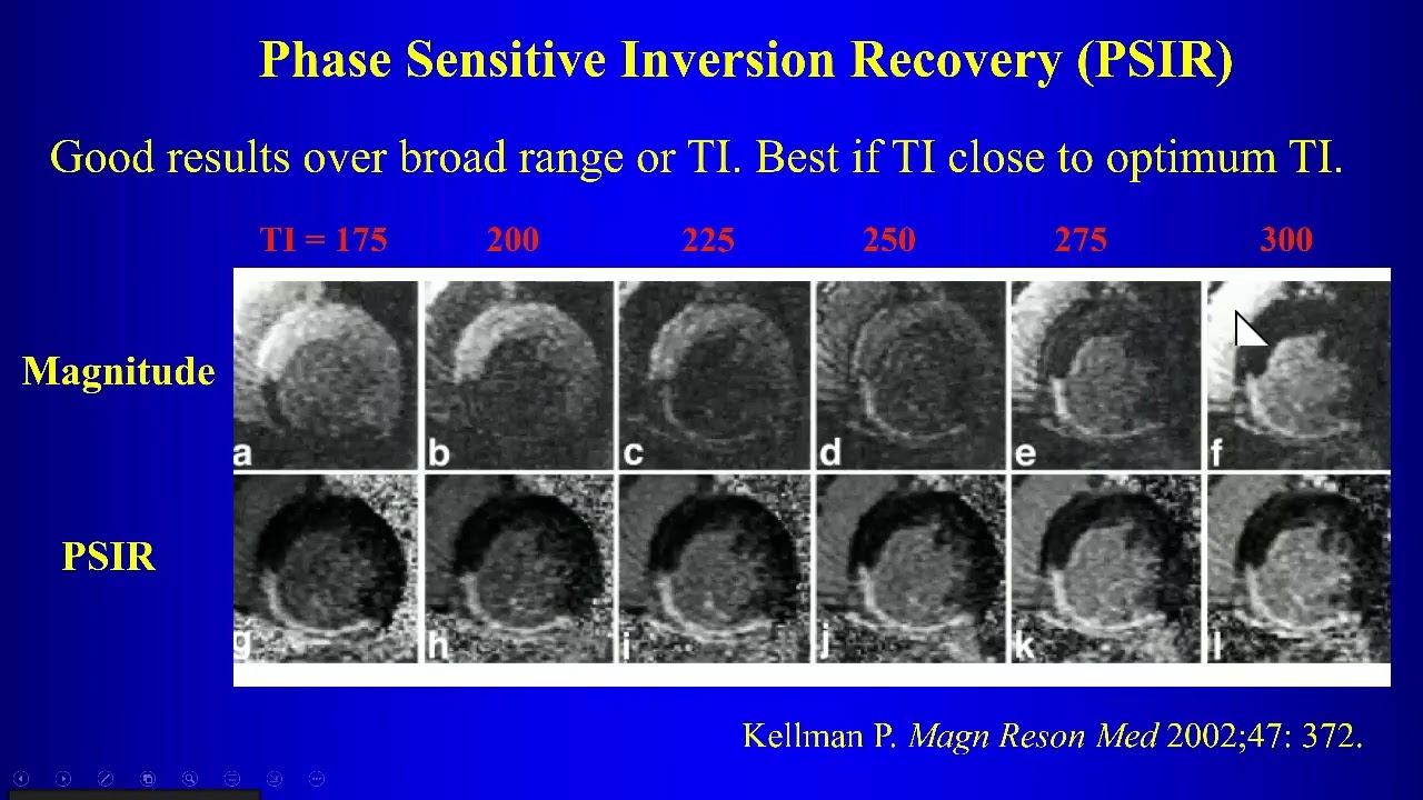 5c Cardiac MRI P3