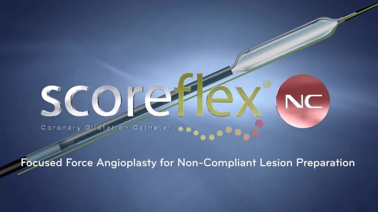Scoreflex NC animation