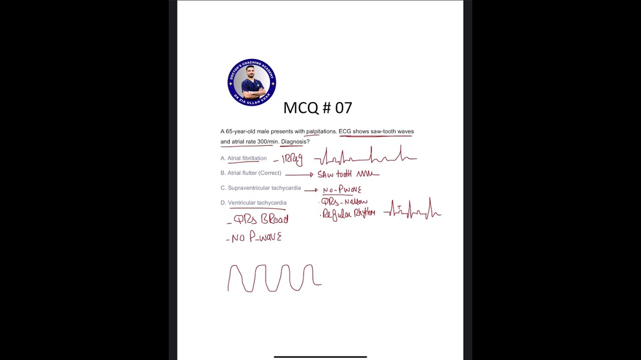 Cardiology Mcqs Explanation part 1 | NRE1