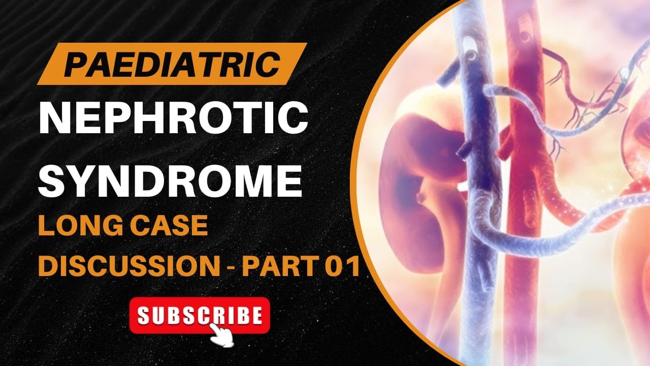 Nephrotic Syndrome - Paediatric Long case discussion MBBS