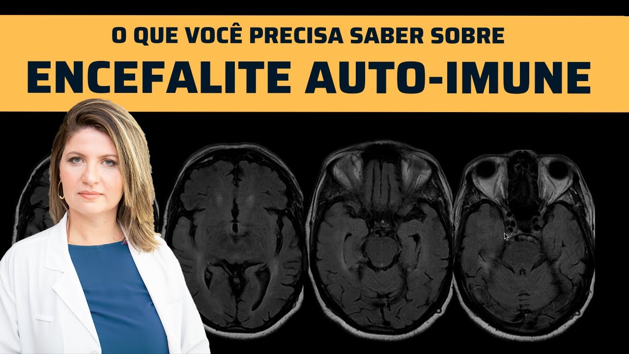 ENCEFALITE AUTO-IMUNE : TUDO O QUE VOCÊ PRECISA SABER