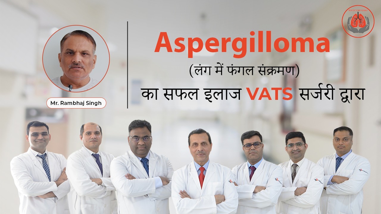Right Side Lung Aspergilloma | Patient Testimonial | Dr. Belal Bin Asaf, Team ICS @Medanta #teamics