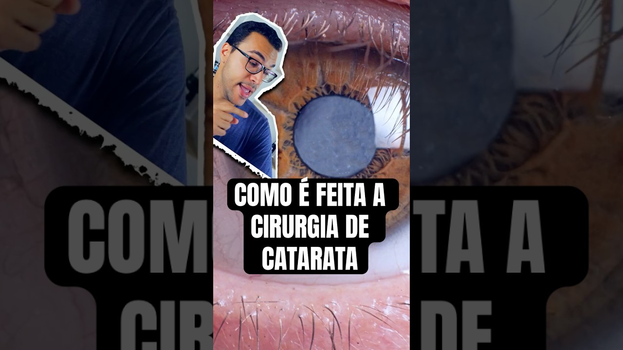 Como &eacute; Feita a CIRURGIA de CATARATA?