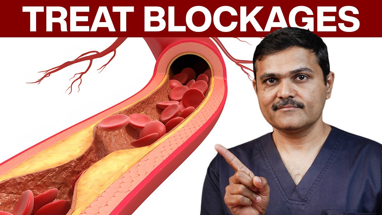 Do These Medicines Really CURE Artery Blockages? A Vascular Surgeon's perspective!