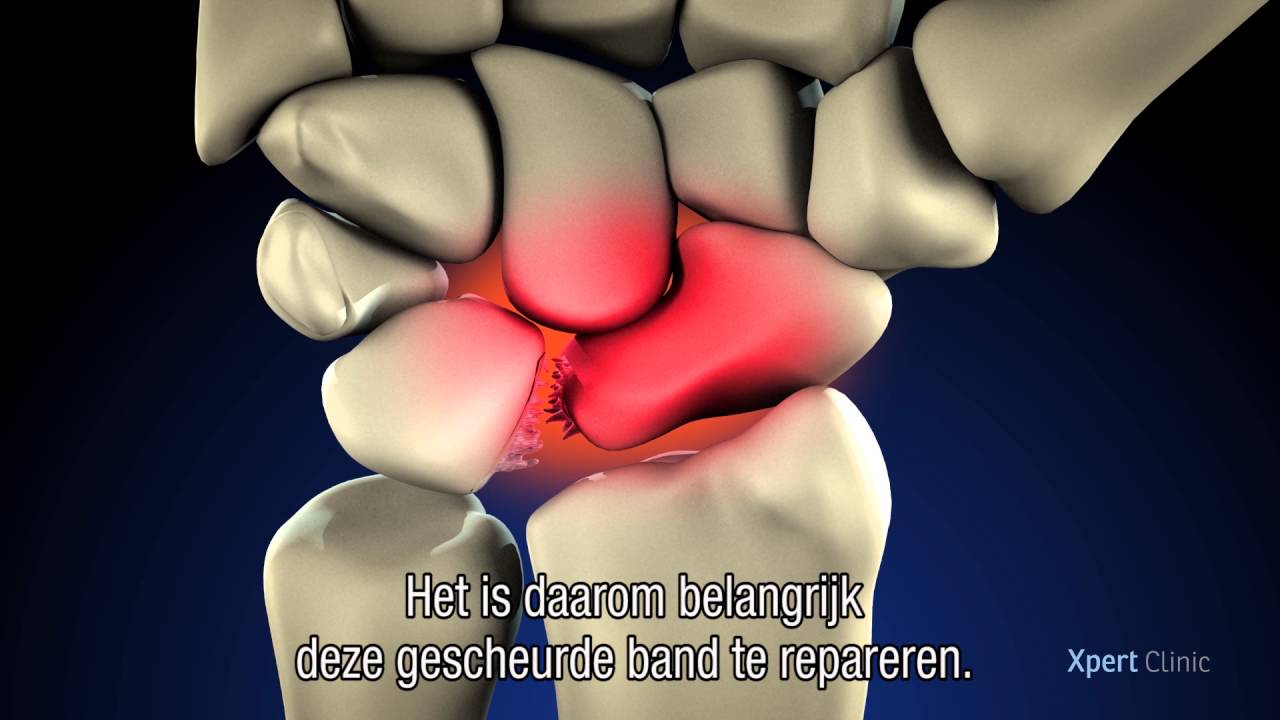 Brunelli Plastiek