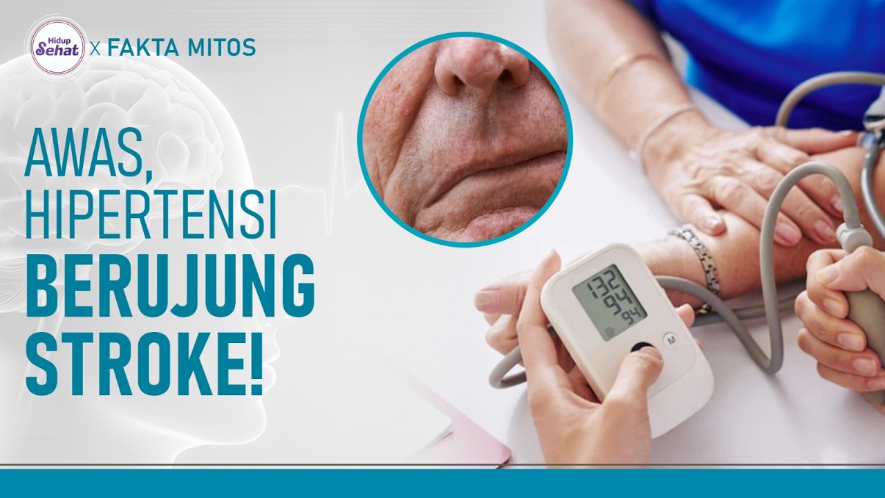 Waspada Stroke pada Penderita Hipertensi, Ini Tips Mencegahnya | Hidup Sehat tvOne