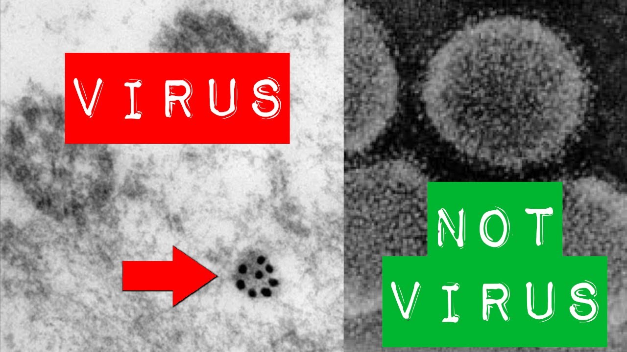 How to identify coronavirus in an electron microscope