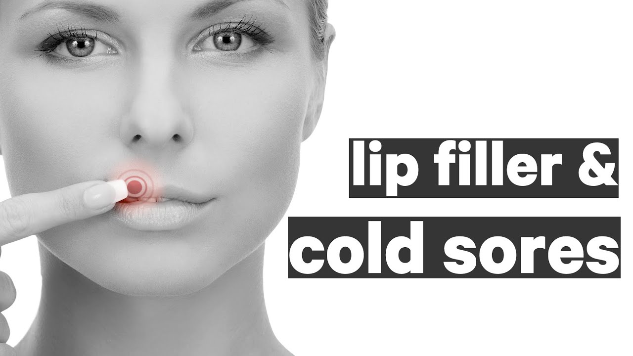 Can you get lip filler with a cold sore? | Q&A | The gift of healthy skin - Episode twenty-two