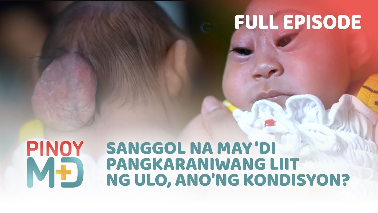 Sanggol na may 'di pangkaraniwang liit ng ulo, ano'ng kondisyon? (Full Episode) | Pinoy MD