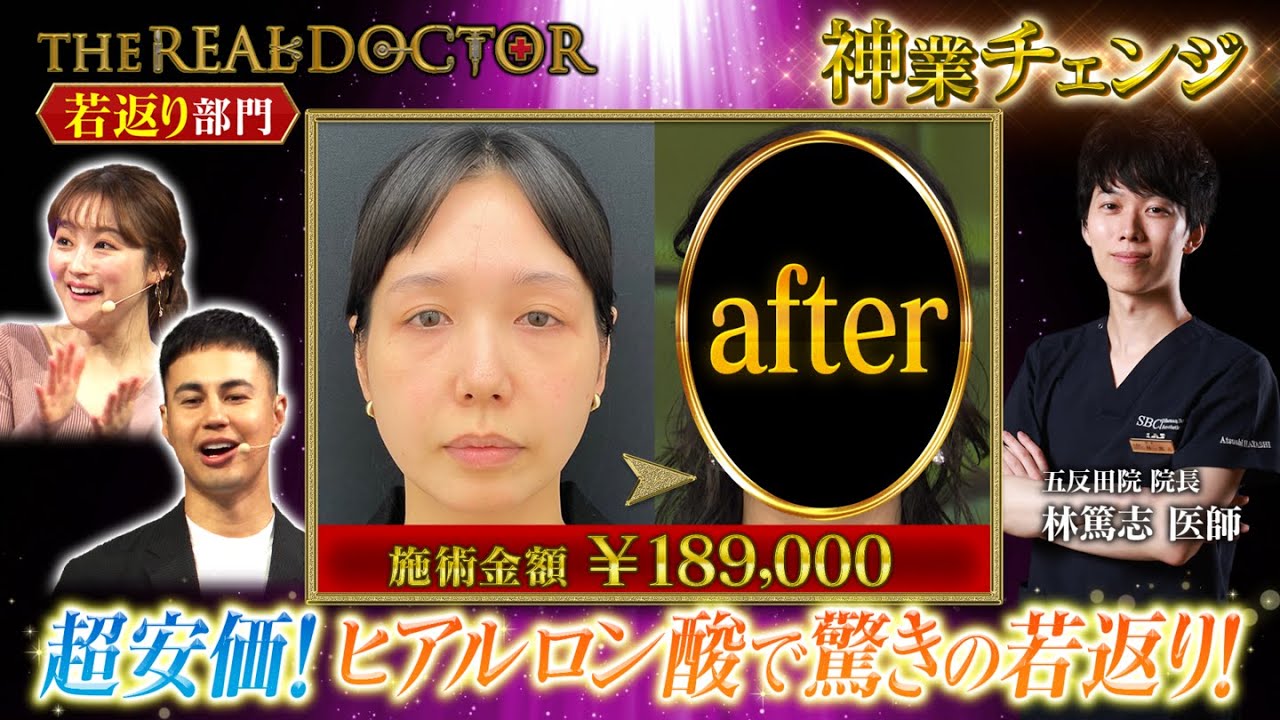 【切らない若返り】30歳代のお顔のたるみを改善して若返らせる東京の神業ドクター