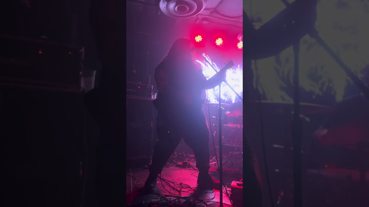 Teeth @ supply and demand; 07/11/2025