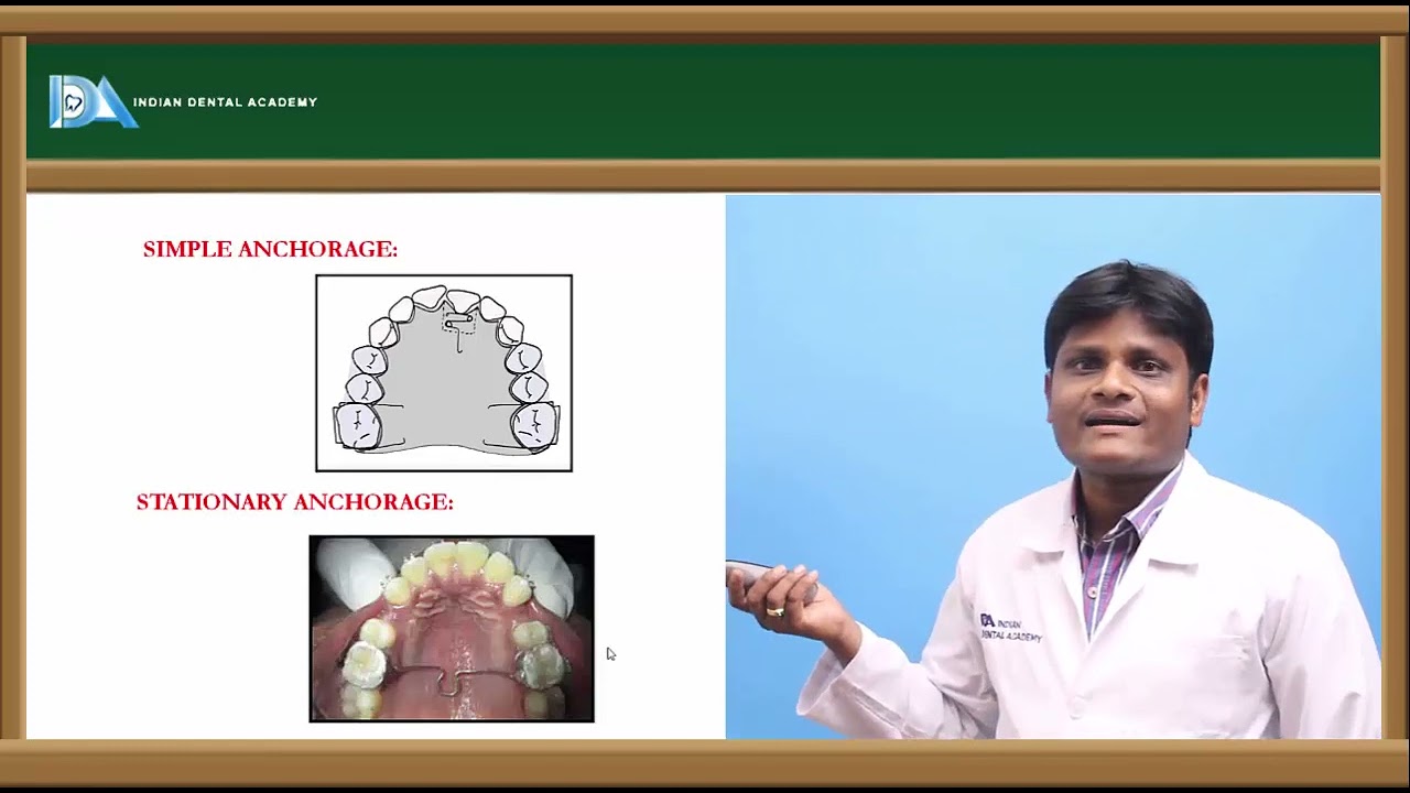 Anchorage in orthodontics | Orthodontics | #NEET#MDS#BDS#NBDE#ORE#DDS