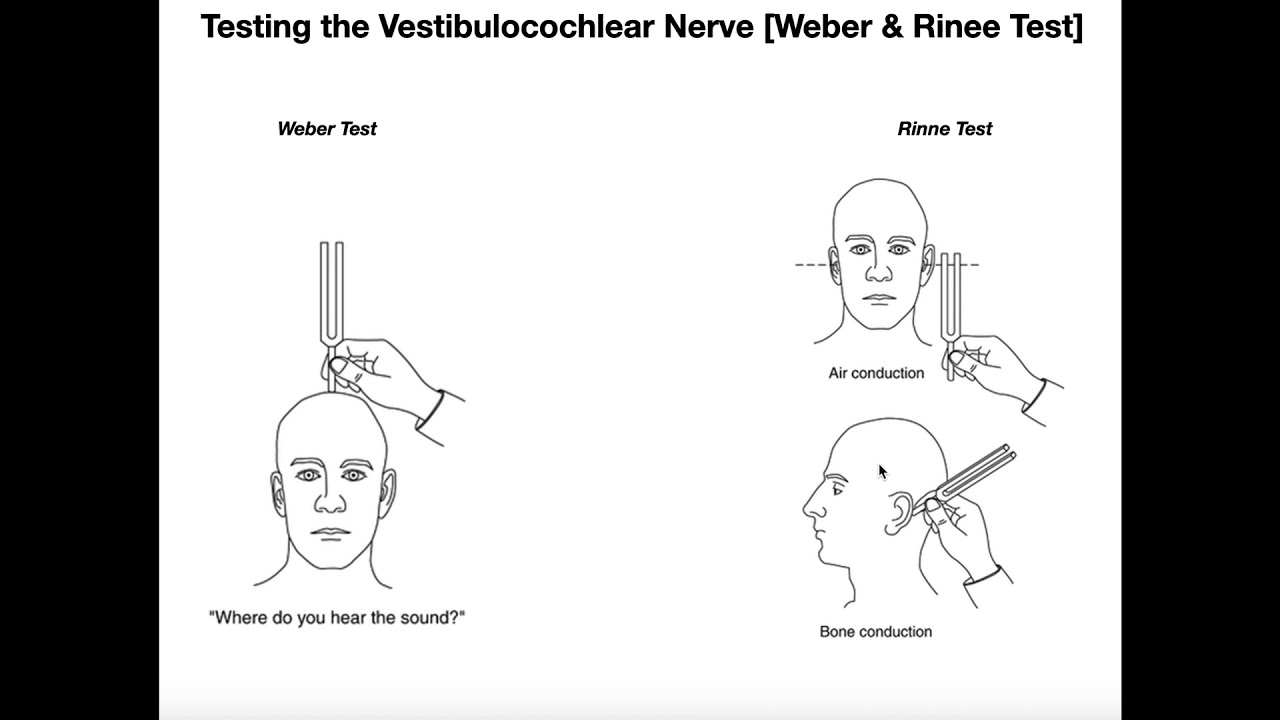 Interpreting the Weber-Rinne Tests EXPLAINED