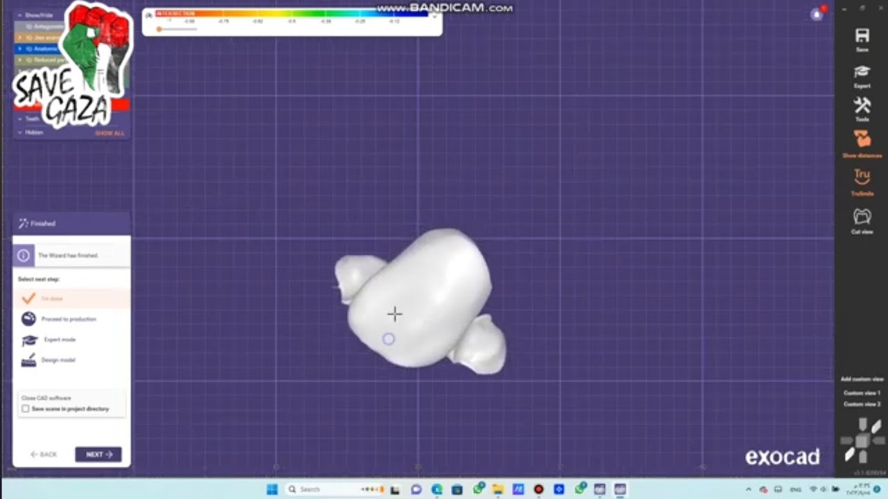 How to design maryland bridge by exocad 2