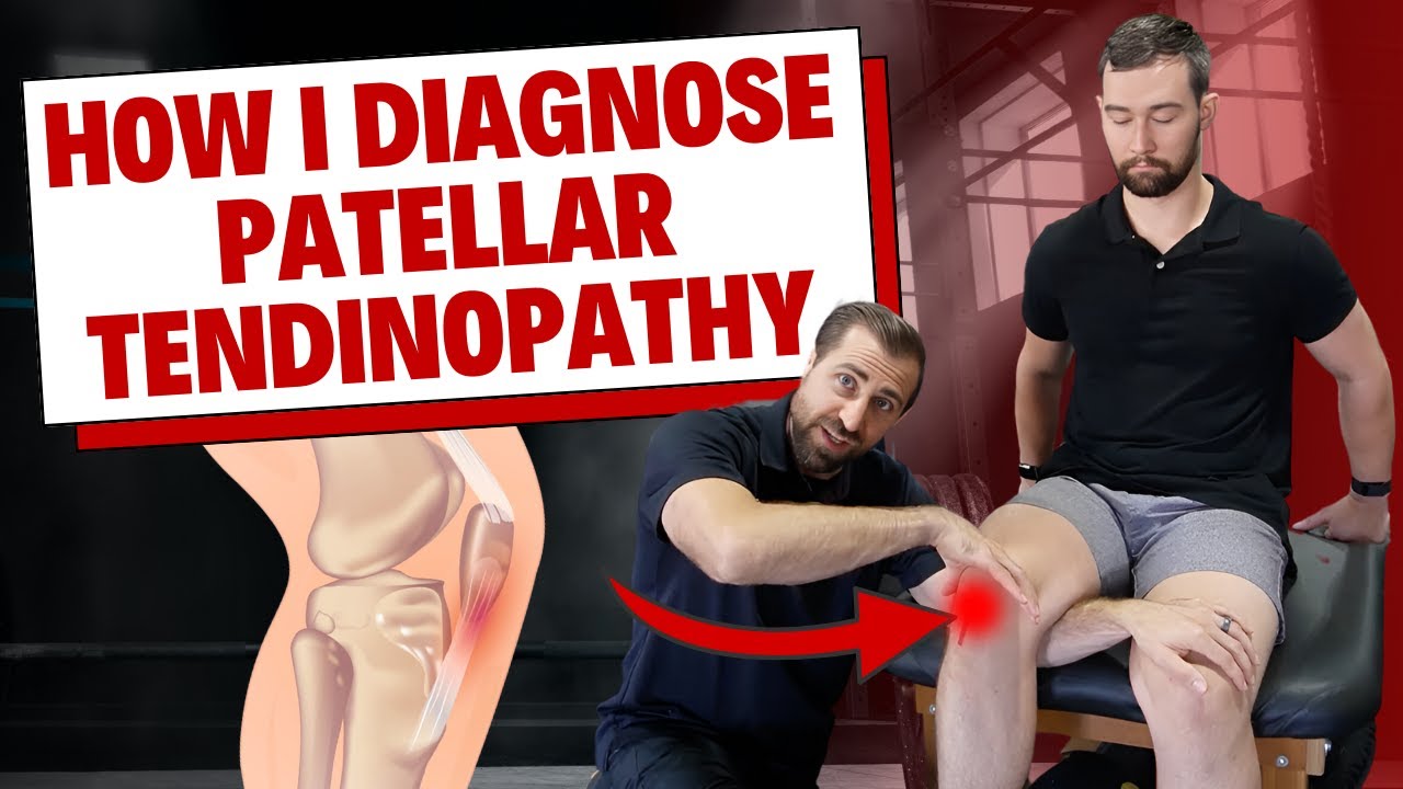 How I Diagnose Patellar Tendinopathy [Clinical Examination]