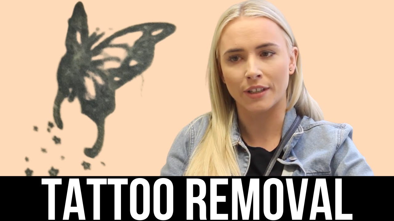 Tattoo Excision - (Surgically Removing a Tattoo) - Before and After