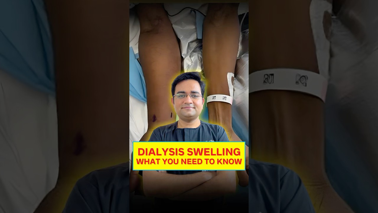 Swelling After Dialysis? It Could Be Central Vein Stenosis