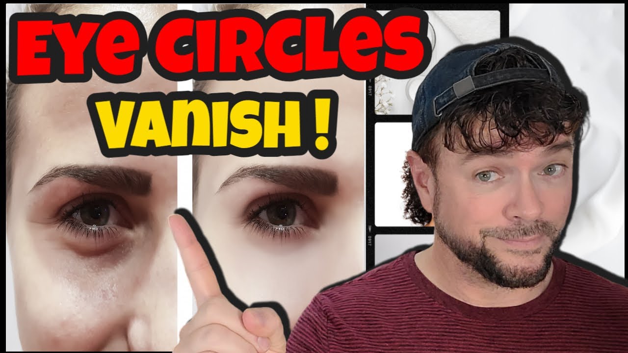 INSTANTLY Make Under Eye Circles Vanish! | Chris Gibson
