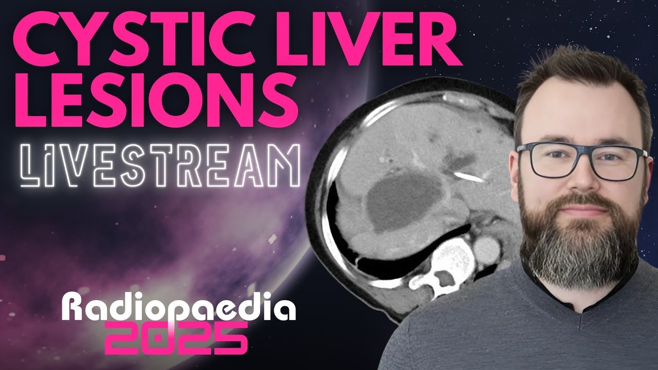 Cystic liver lesions with Joe Mullineux