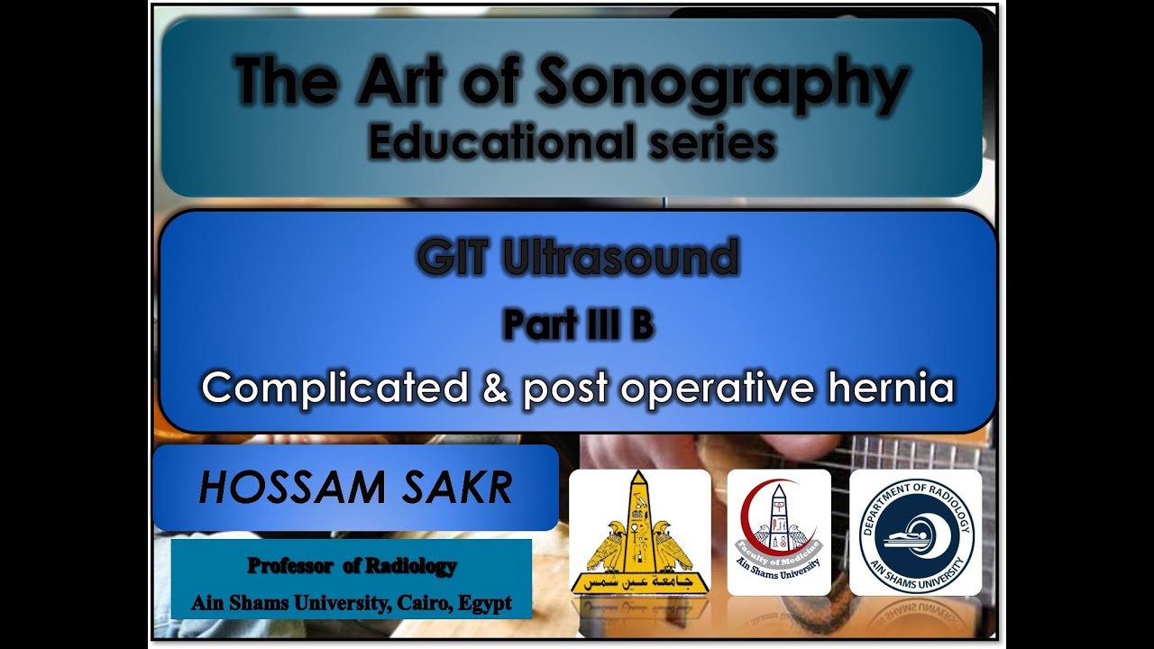 GIT US PART III B Complicated & post operative hernia