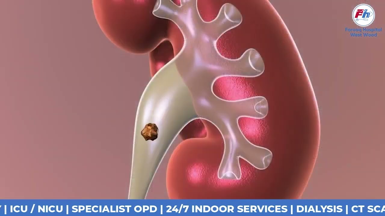 Dr. Ghulam Mujtaba Zafar: Pediatric Urologist Extraordinaire