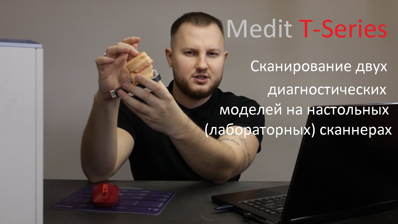 Сканирование двух диагностических  моделей на настольных(лабораторных) сканнерах / Medit T-series