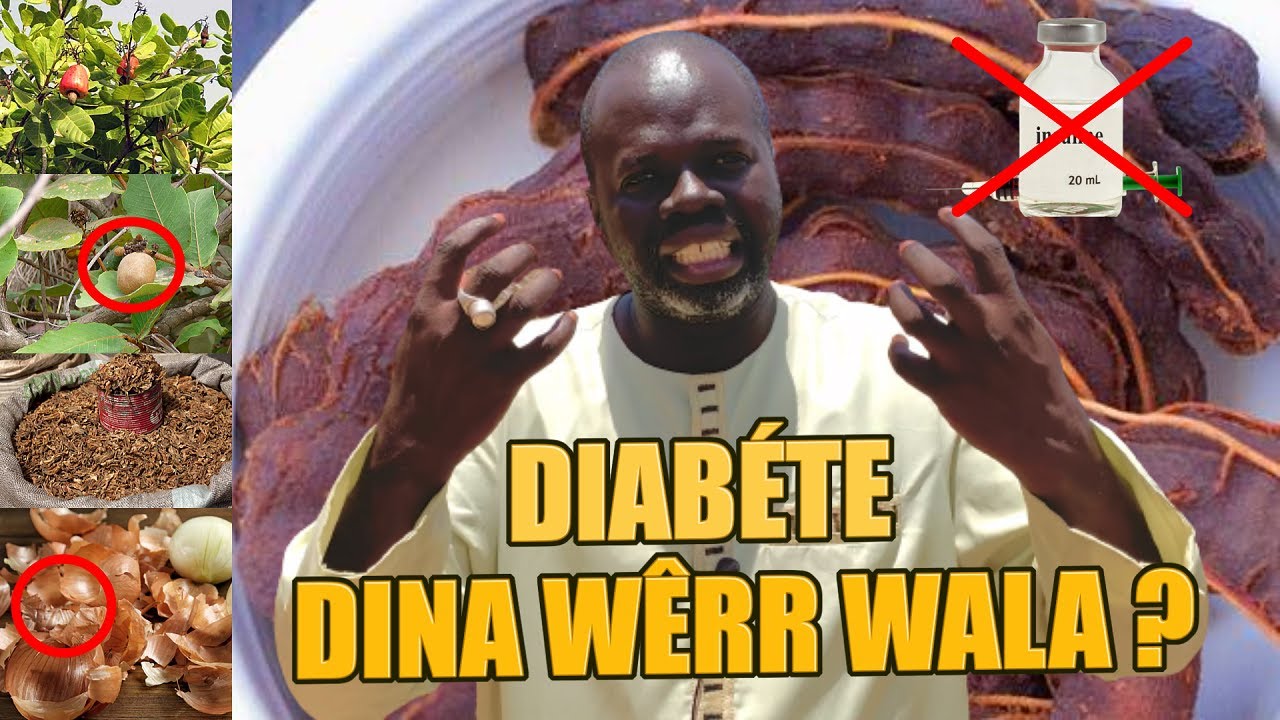 #2 - SOLUTIONS DIABÉTE: DAKHAAR, NÉW,  wala DARKASÉ, Pr Ousmane Ndiaye - SAMA XALAAT TV