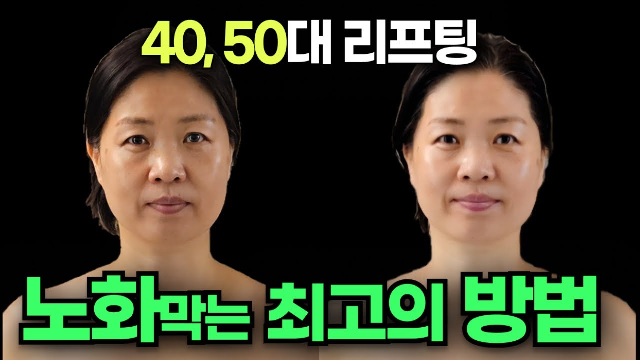 [노화, 붓기]성형없이 자연스럽게 얼굴 리프팅되는 동안얼굴만들기