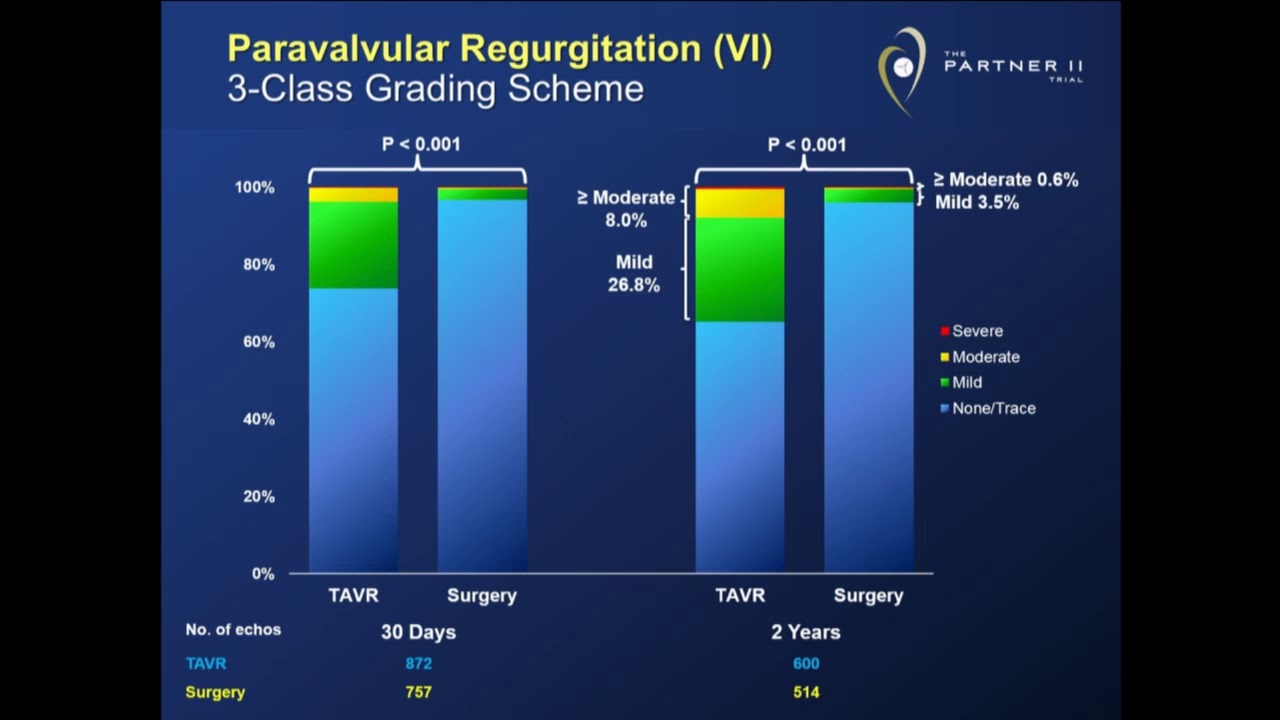 TAVR is an All Comers Therapy - Michael Reardon, MD