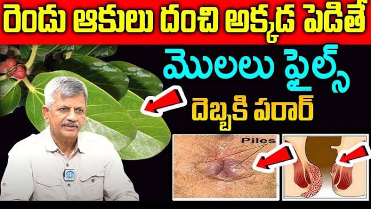 రెండు ఆకులు దంచి అక్కడ పెడితే మొలలు శాశ్వతంగా మాయం | eliminate the warts forever | Anjanya Raju