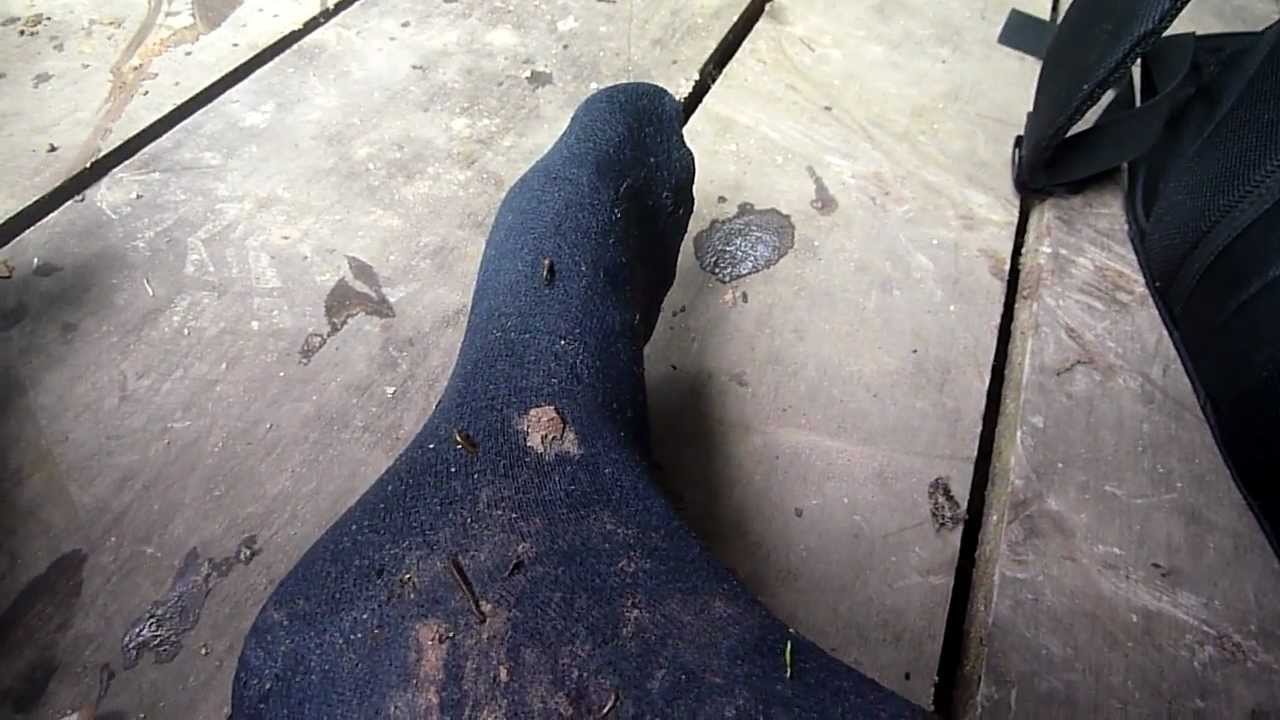 Leeches on my foot after walking through the rainforest