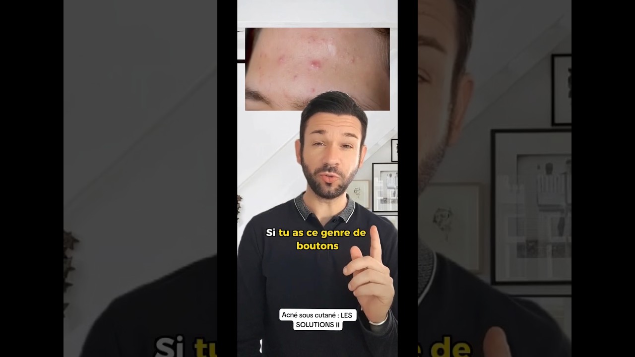 L&rsquo;acn&eacute; sous cutan&eacute; a ses solutions !!