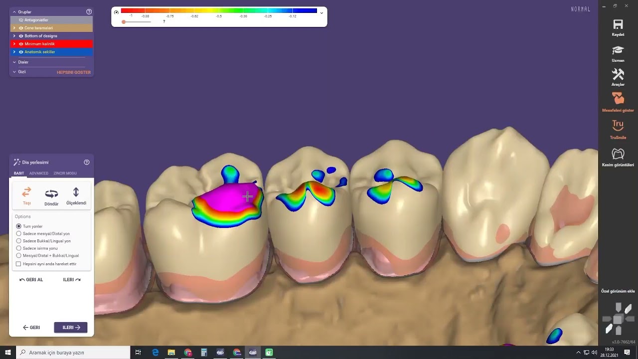 EXOCAD DENTAL TASARIM PROGRAMI İLE ÜST ÇENE  GEÇİCİ DİZAYN