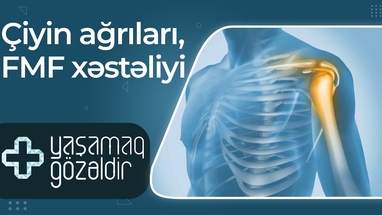 Çiyin ağrıları, FMF xəstəliyi - Musa Kılıç, Camal Hacıyev - 18.05.2022 - Yaşamaq Gözəldir