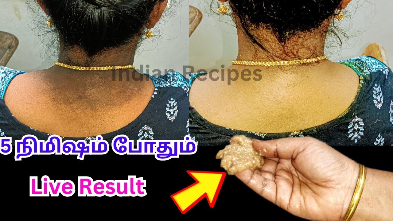 Oh my, in just 2 minutes, the dark neck disappeared magically, dark neck whitening skin whitening